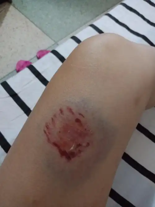 身上有伤的照片.但没有去医院检查可以去做伤情鉴定吗