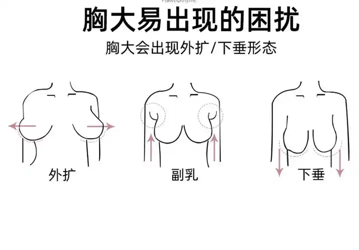 花婉韵调整型内衣矫正外扩下垂小胸聚拢神器强收副乳神器高侧比6排搭