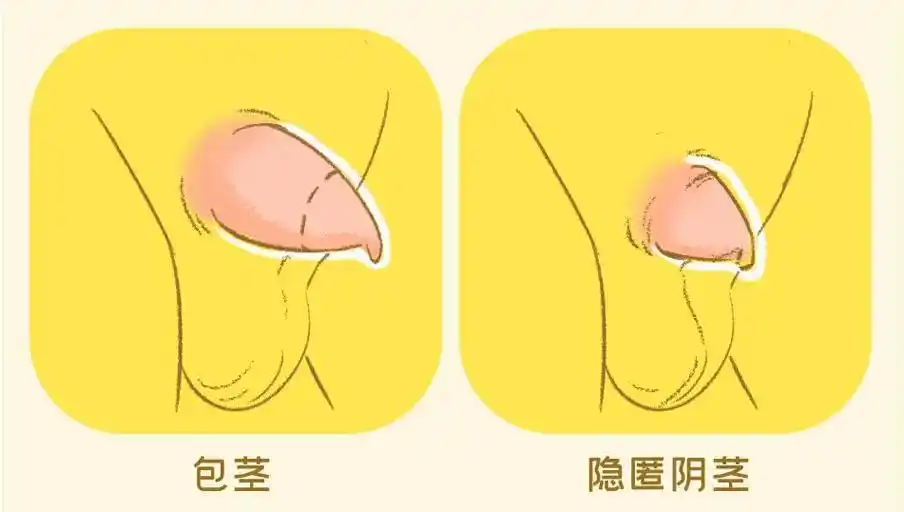 小心耽误孩子!男宝"蛋蛋"出现这几种情况要重视,越早检查越好