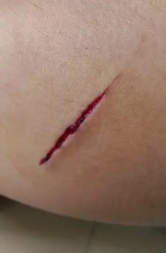 被砍的伤口涂画中,新鲜被砍的伤口哦!