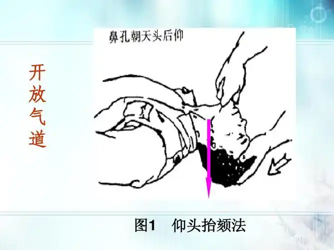 3.19 心肺复苏ppt