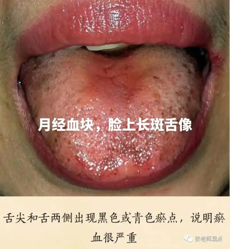 淤血各种各样的舌像 - 抖音