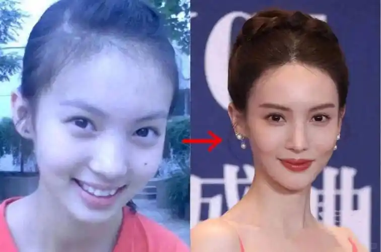 这一次,谁都救不了金晨,暴瘦脱相,过度医美,畸形审美毒害下的她!