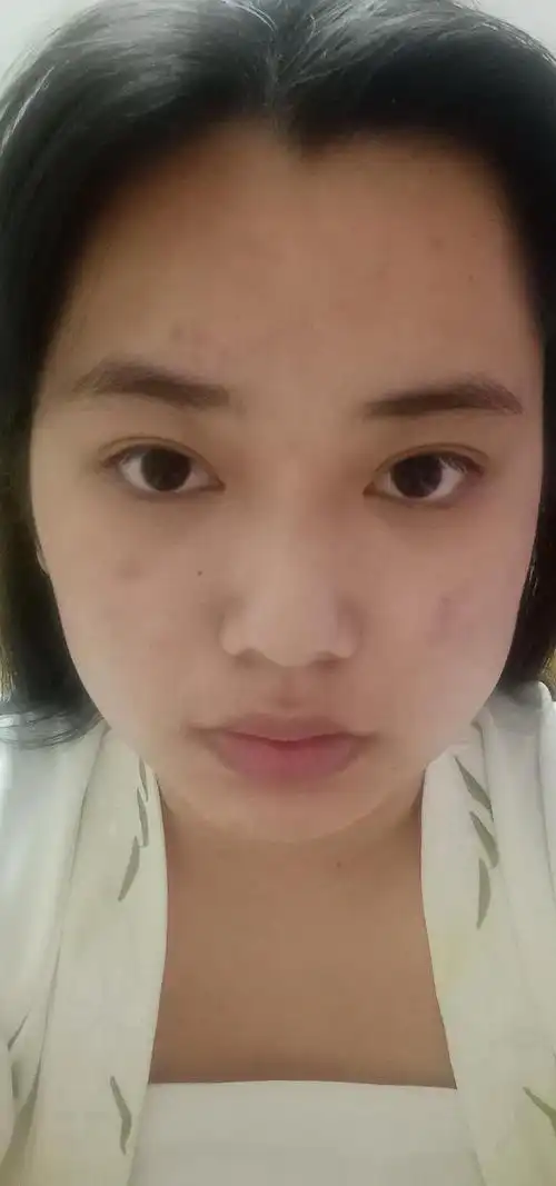 手机前置自拍素颜没洗脸很丑