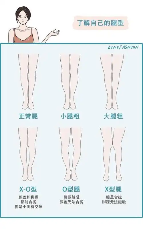 形体管理|直腿术能矫正o型腿或x型腿等不好看腿型吗?