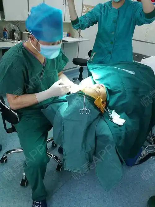 膨体假体隆鼻手术当天_鼻部多项手术当天_隆鼻手术当天_鼻部整形手术