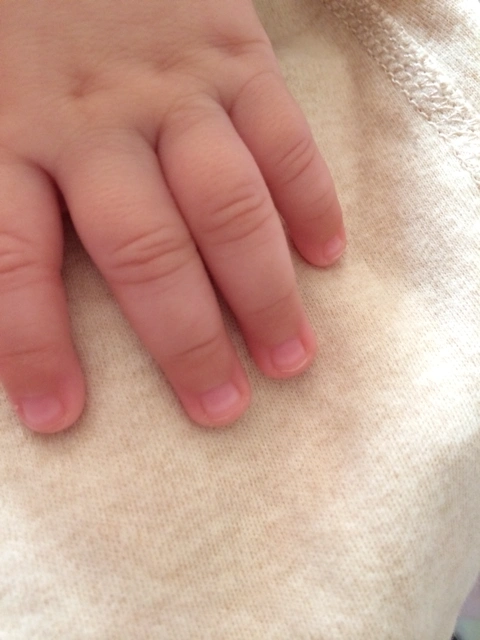 宝宝指甲这样正常吗