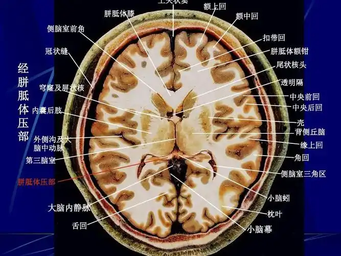 头 透明隔 中央前回 中央后回 壳 背侧丘脑 缘上回 角回 侧脑室三角区