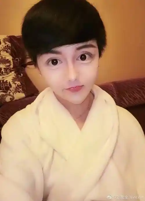 他又去注射了80支玻尿酸融掉50只玻尿酸后的第四天然而,就融掉脸上50