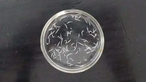 可怕凌晨四点宝宝pp里爬出白虫妈妈迅速送到小榄人民医院