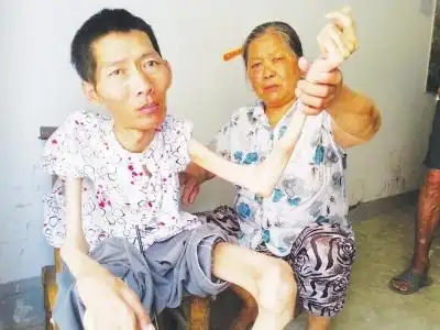 丁黑蛋瘦成皮包骨了