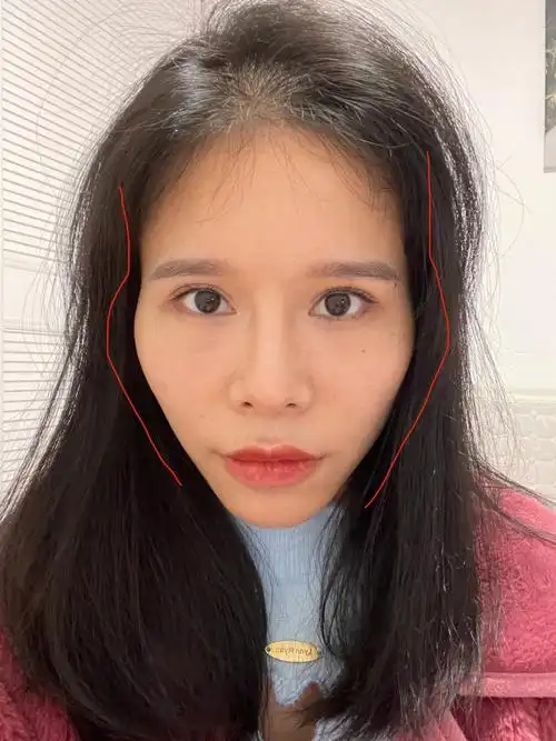 太阳穴凹陷颧骨凸沃日这鬼脸型