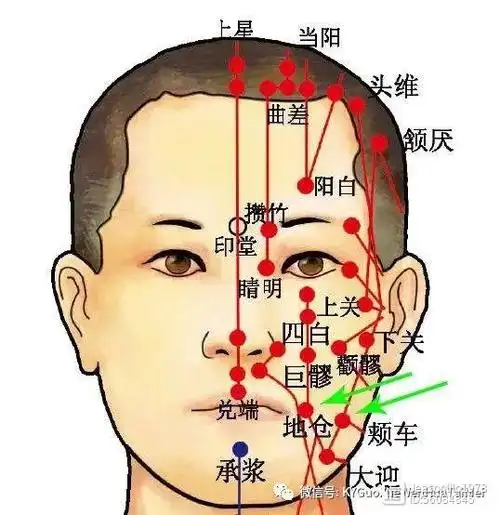针灸篇20.【面部中风与起因】