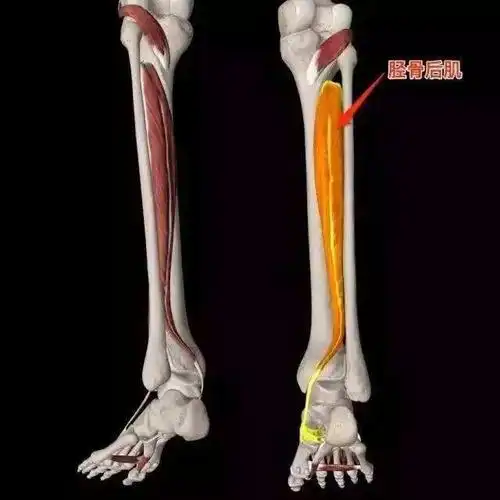 「运动康复」胫骨后肌失能与扁平足-跑者的噩梦_肌腱