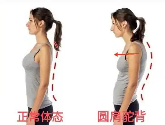 身体前侧肌肉特别紧张,就把手臂和肩胛骨往前拉