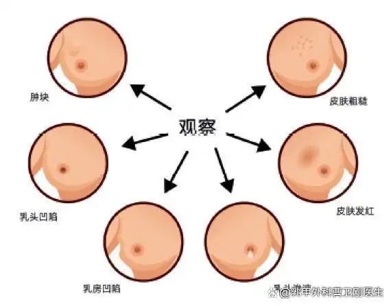 乳腺癌病因发病率症状分类分型预防治疗预后的解答
