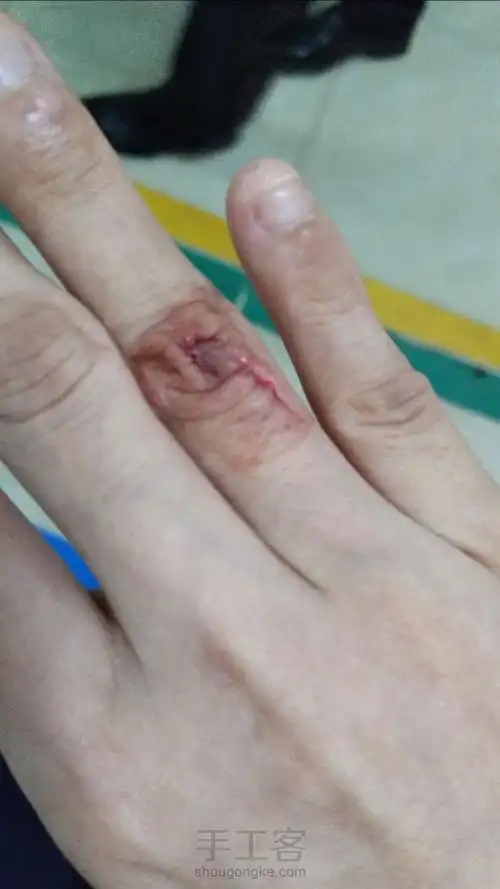 抱歉大家,右手严重被玻璃划伤,现在右手不能弯了,需要修养一阵了.