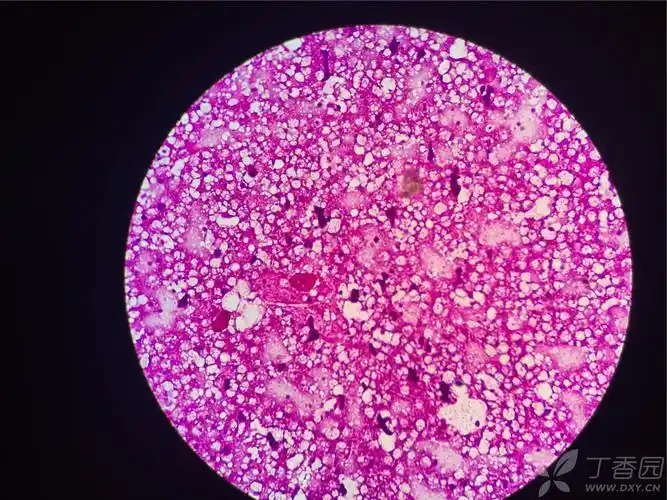 小师弟诚挚邀请各路大神帮我看看这个肝脏组织切片