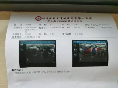 爷爷几天前因胸腔积水检查得知癌症请大家帮帮忙