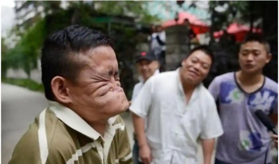 最奇葩吉尼斯世界纪录世界上最丑的人还是中国人特别像首富