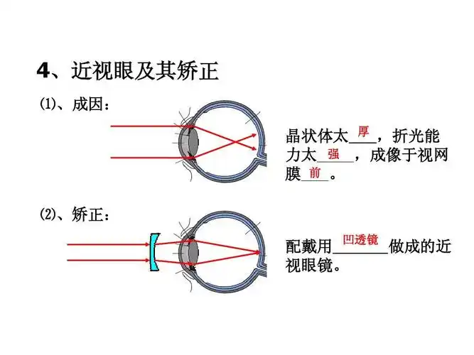 分类 初中教育 理化生 免费课件眼睛与视力矫正ppt 4,近视眼及其矫正
