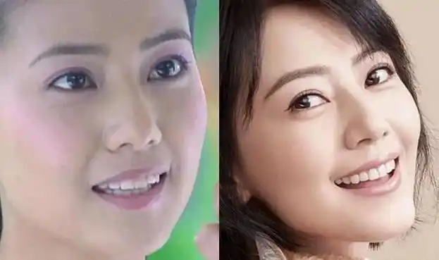 不过一口好牙确实能给一个人的颜值加分,就想高圆圆在整牙之前,虽然