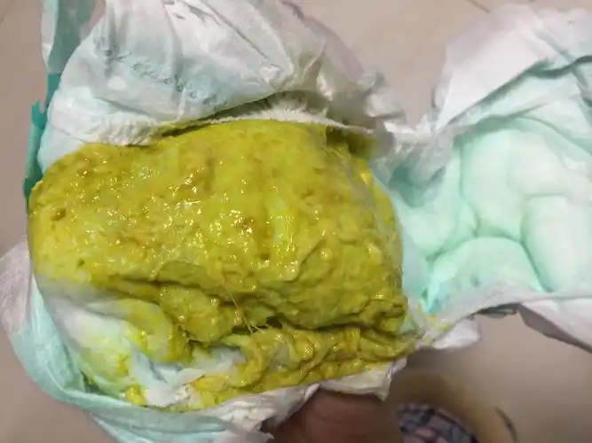 宝宝十个月这两天拉油状大便一天三四次