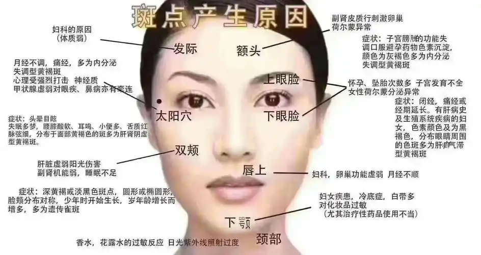 九张图片带你了解斑的形成和原因