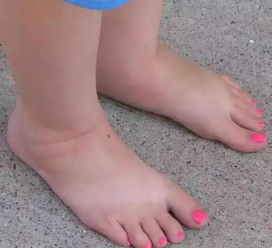 怎样让脚变瘦?女生脚胖怎么办?