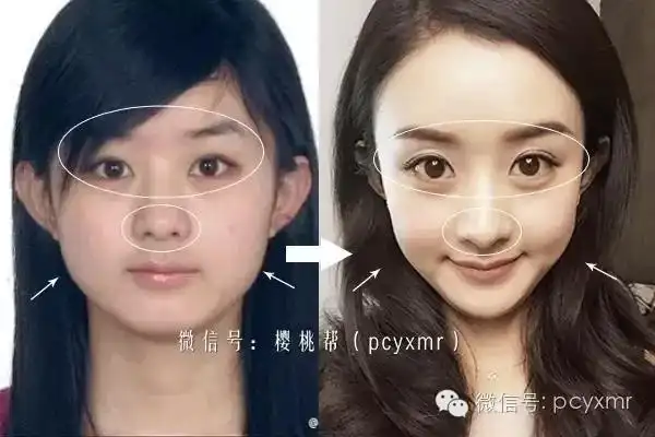 双眼皮先调整一下弧度, 眼睛从细长型变得又大又圆!