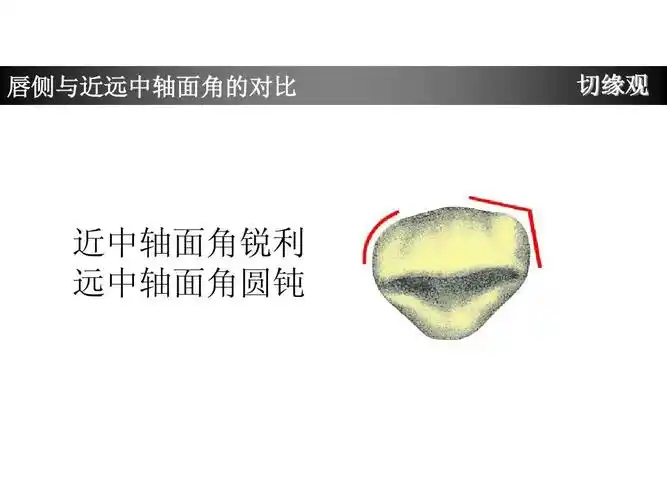 唇侧与近远中轴面角的对比 切缘观 近中轴面角锐利 远中轴面角圆钝
