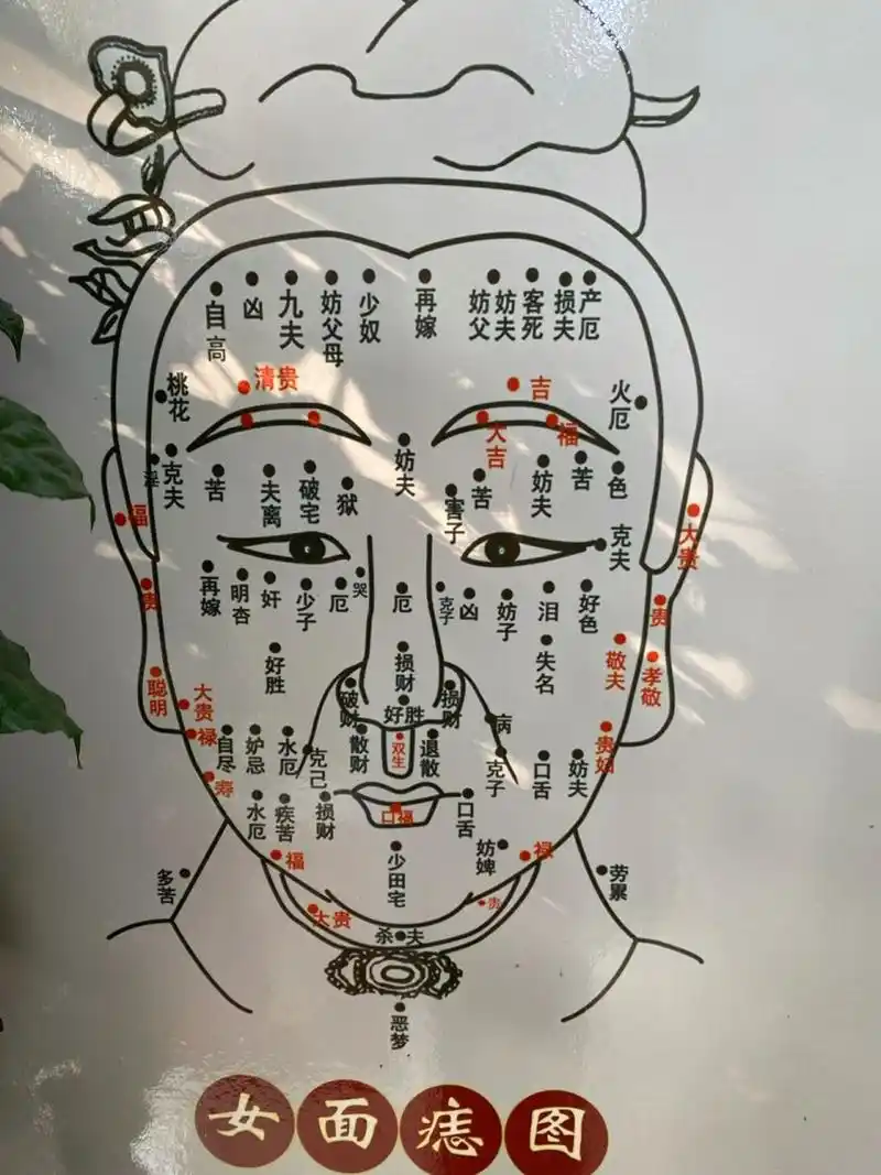最靠谱的痣图 留下福气痣,祛掉应该祛的痣.