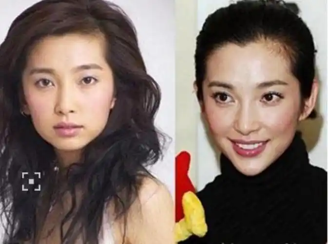 李冰冰整容前后李冰冰数次整容调整