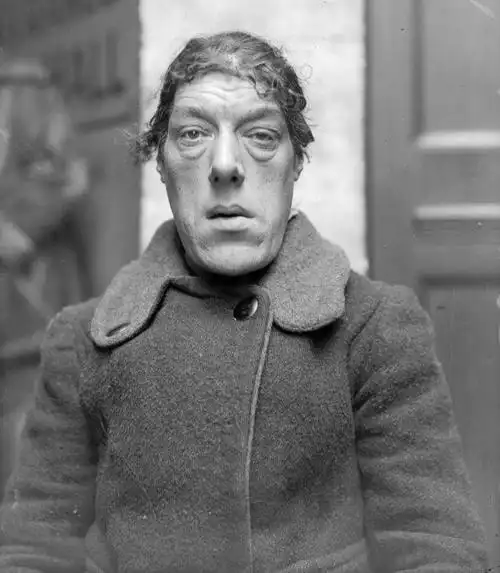 世界上最丑的人(盘点称为"世界上最丑的女人"背后的故事)