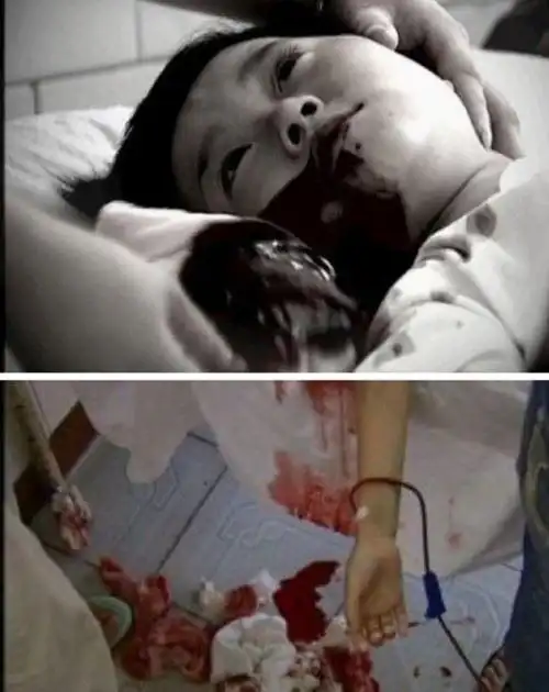 小苏丽事件是真的吗小苏丽验尸照片死后遭亲生母亲扒坟