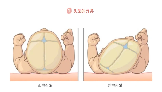 新生儿头颅扫最全扫描介绍