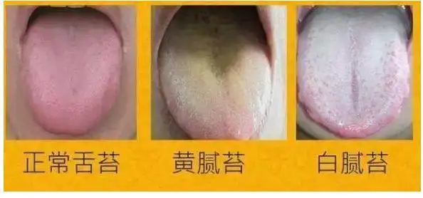 (图片宝宝舌苔就是薄白苔)一般一岁以上宝宝正常的大便都是条状黄色