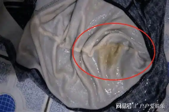 女大学生底裤总泛黄,检查出hpv,查明原因,怒斥男友害人害己