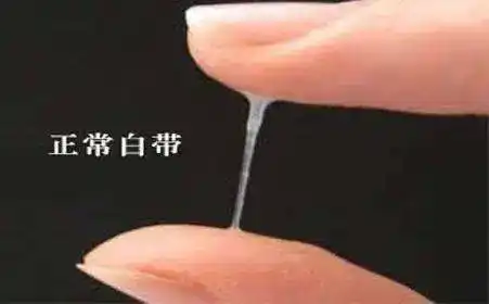 阴道_分泌物_治疗