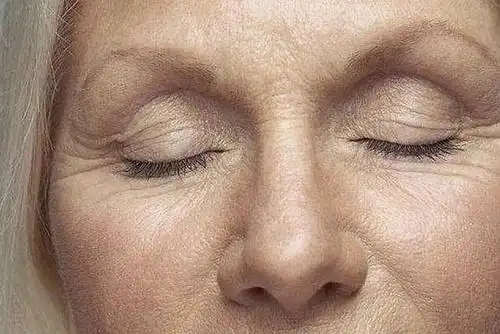 从五官就能看出脾胃好不好 一,面色:面色萎黄多见于脾胃虚弱