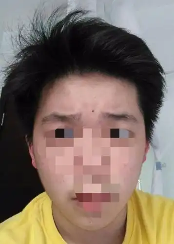 我的额头窄吗 我算是什么脸型