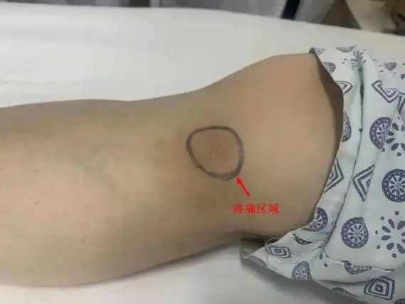 膝盖里有个小肿块挂什么科(年轻小伙膝盖疼痛两年)(1)