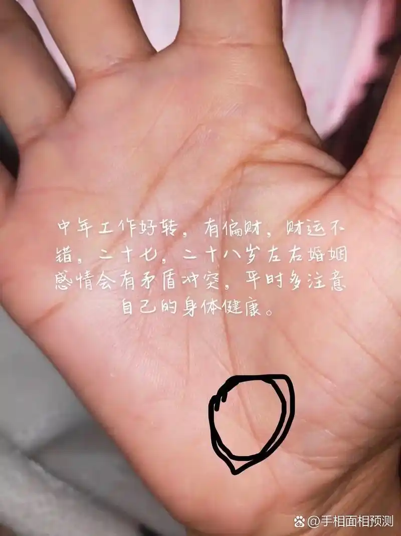 生命线上出现三角纹,只有知道在哪个年龄段才能更好的预防.