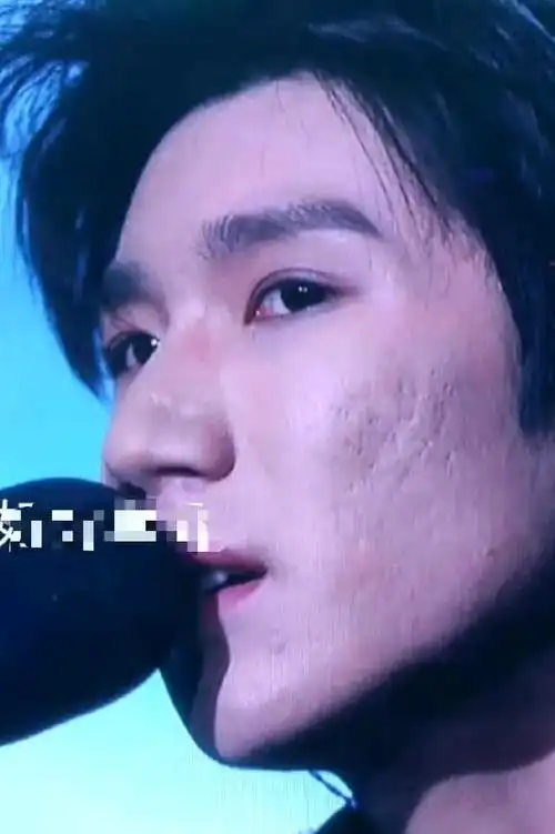 王源生图状态引热议!脸部浮肿,痘坑明显,满脸沧桑像几天没睡觉