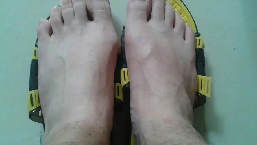 脚上好多筋,晚上熬夜多,身体好多毒素该怎么运动,吃什么排毒,_百度知