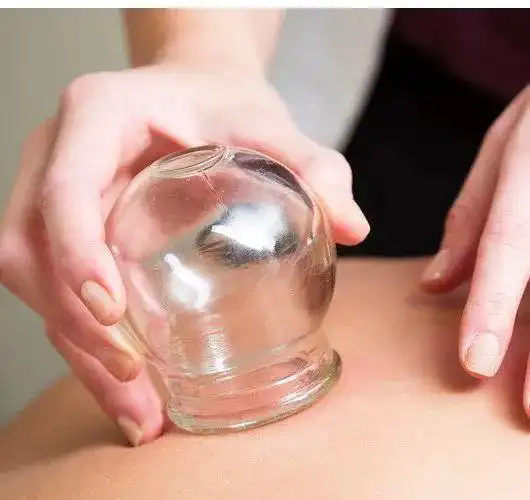 拔罐并不是哪痛就拔哪