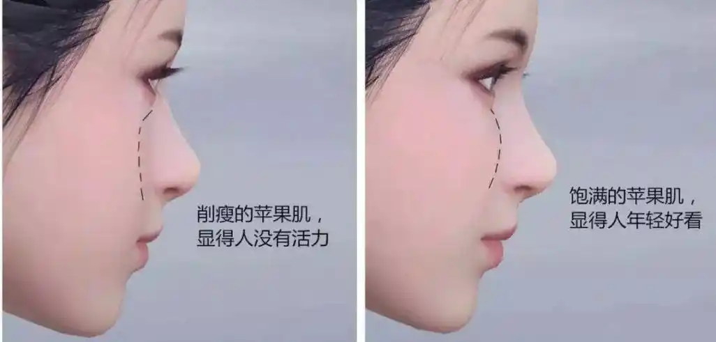 靠这三种方法秒让你的苹果肌嘭嘭嘭起来