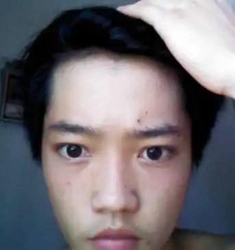 男人身上的富痣这几处有痣的人财运好会赚钱你有吗