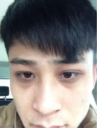 现在很多人都习惯熬夜,第二天起来,黑眼圈,眼袋十分严重,那么我们