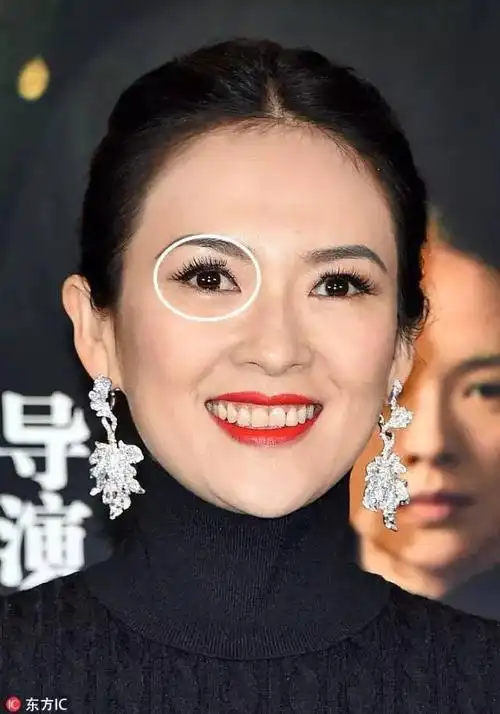 江疏影用这个神器搞出了开眼角割双眼皮的效果